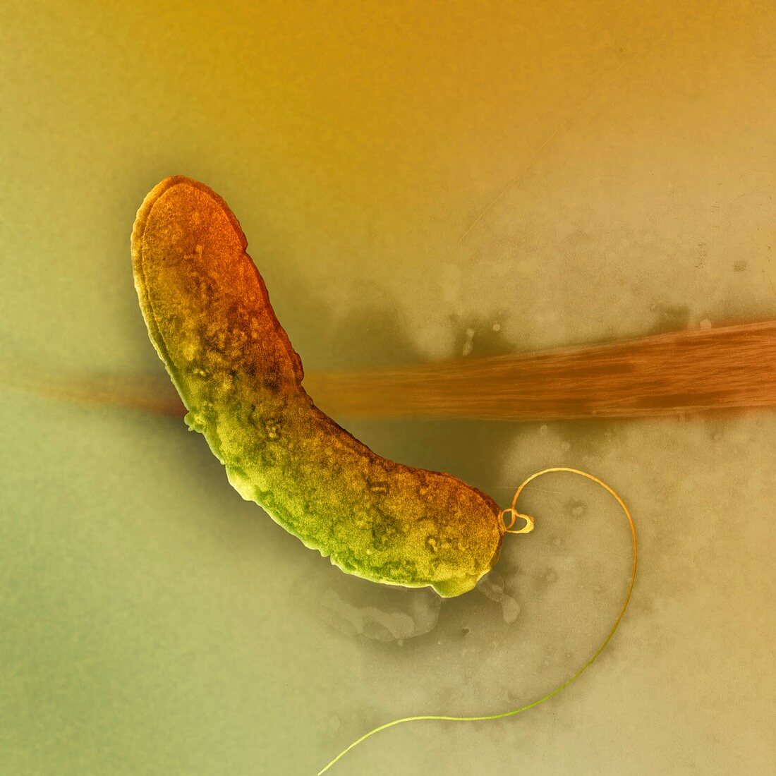 Cholera bacterium,TEM