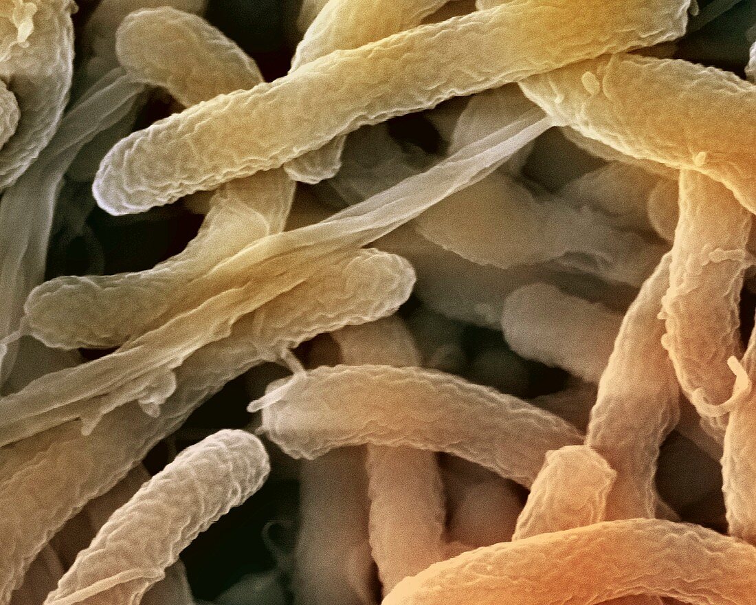 Cholera bacteria,SEM