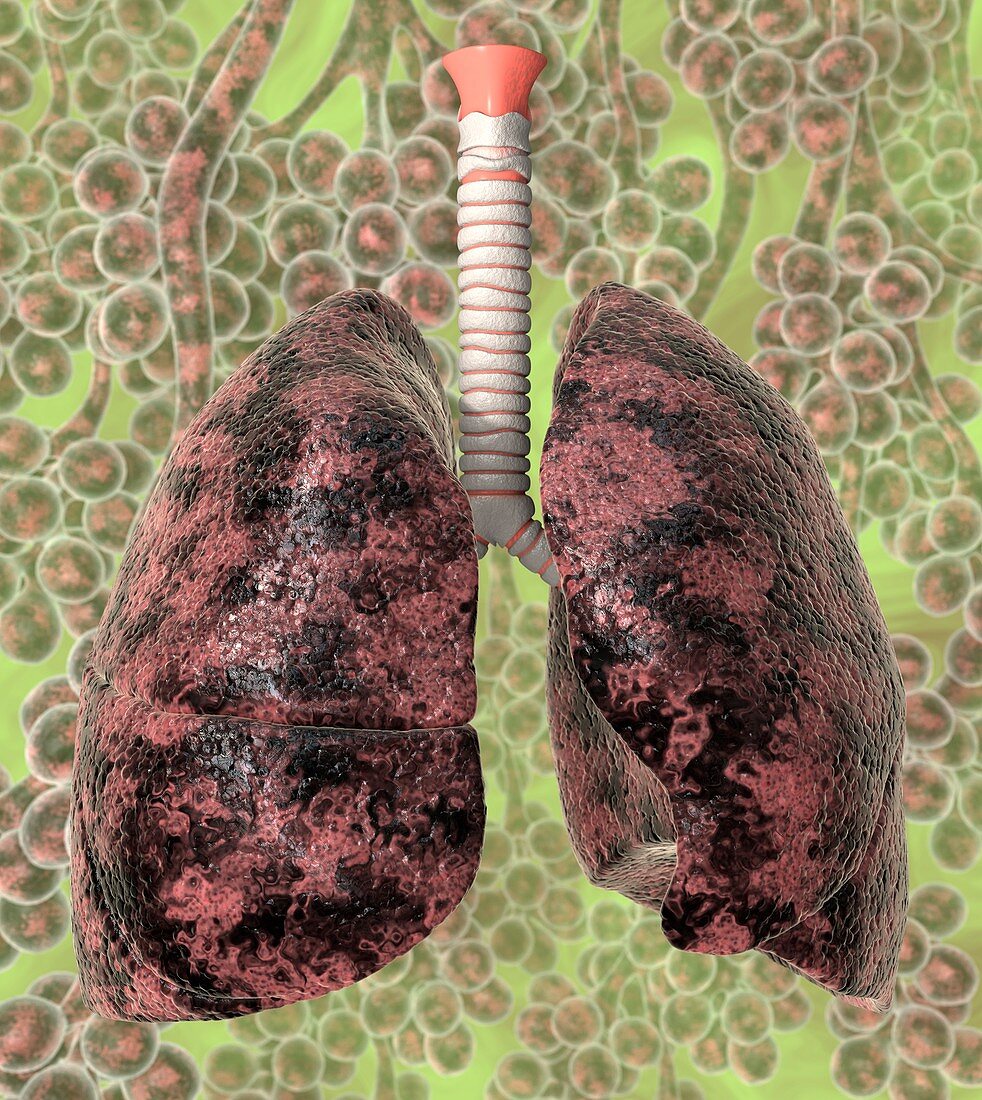 Smoker's lungs,artwork