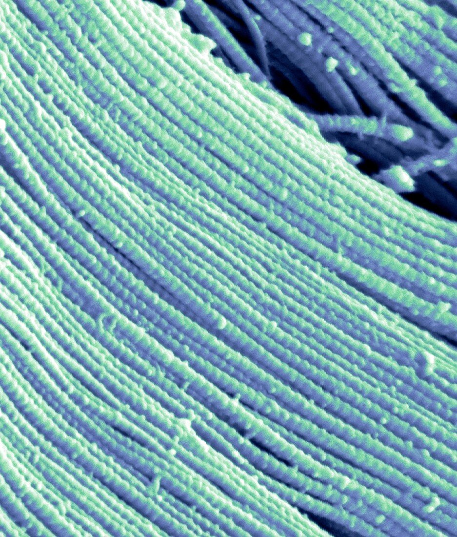 Collagen fibres,SEM