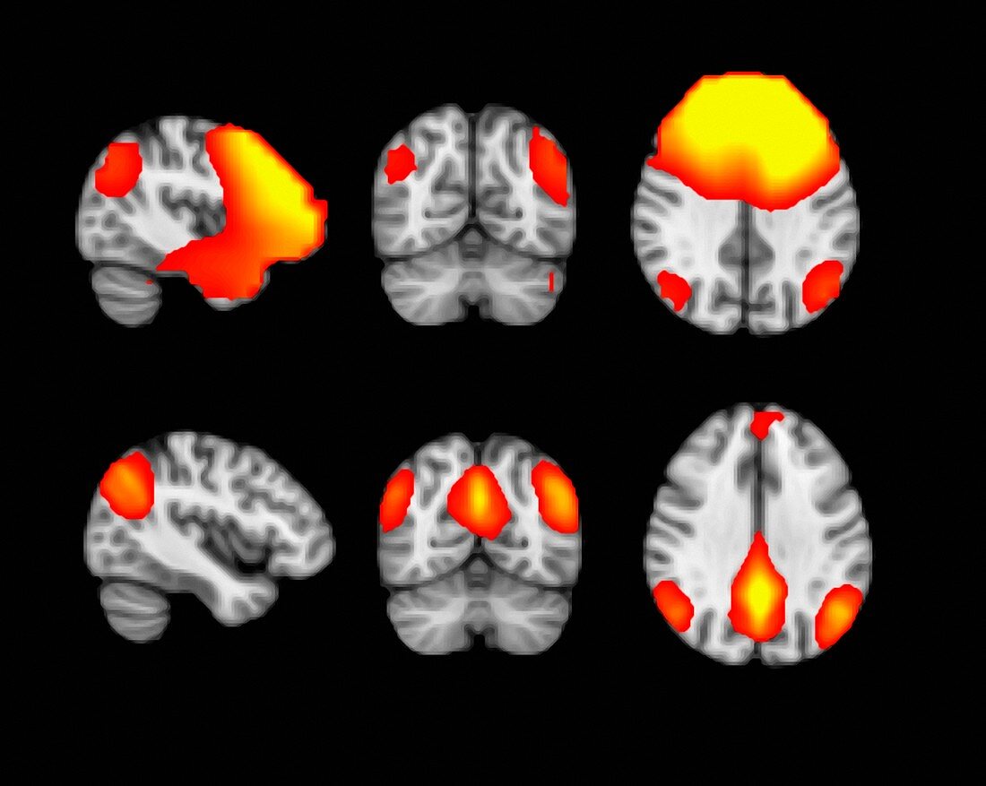 MEG and fMRI Brain Scans