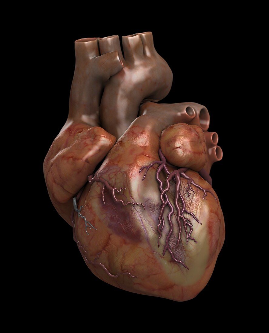 Heart and coronary arteries,3D artwork
