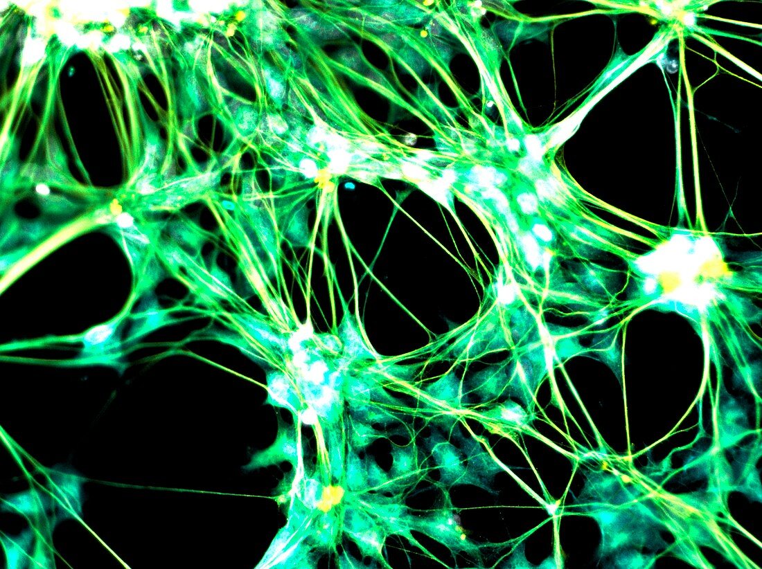 Neural stem cell culture