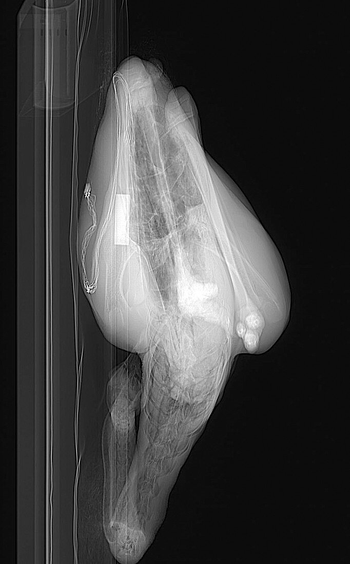 Emu,CT scan