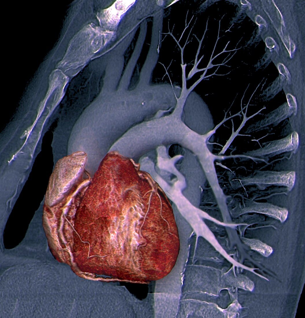 Healthy heart,3D CT scan