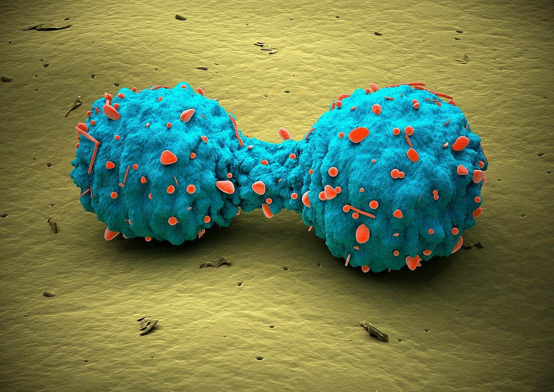 Lung cancer cell division,artwork