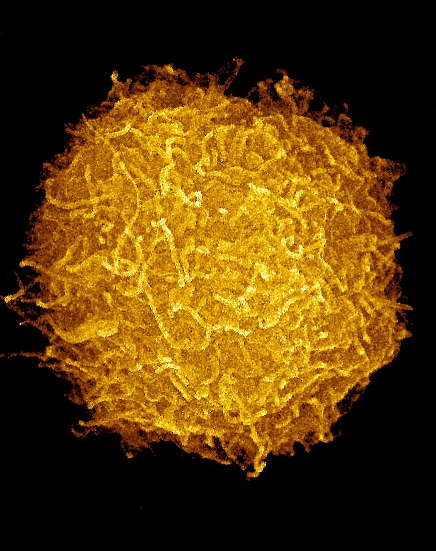 Prostate cancer cell,SEM