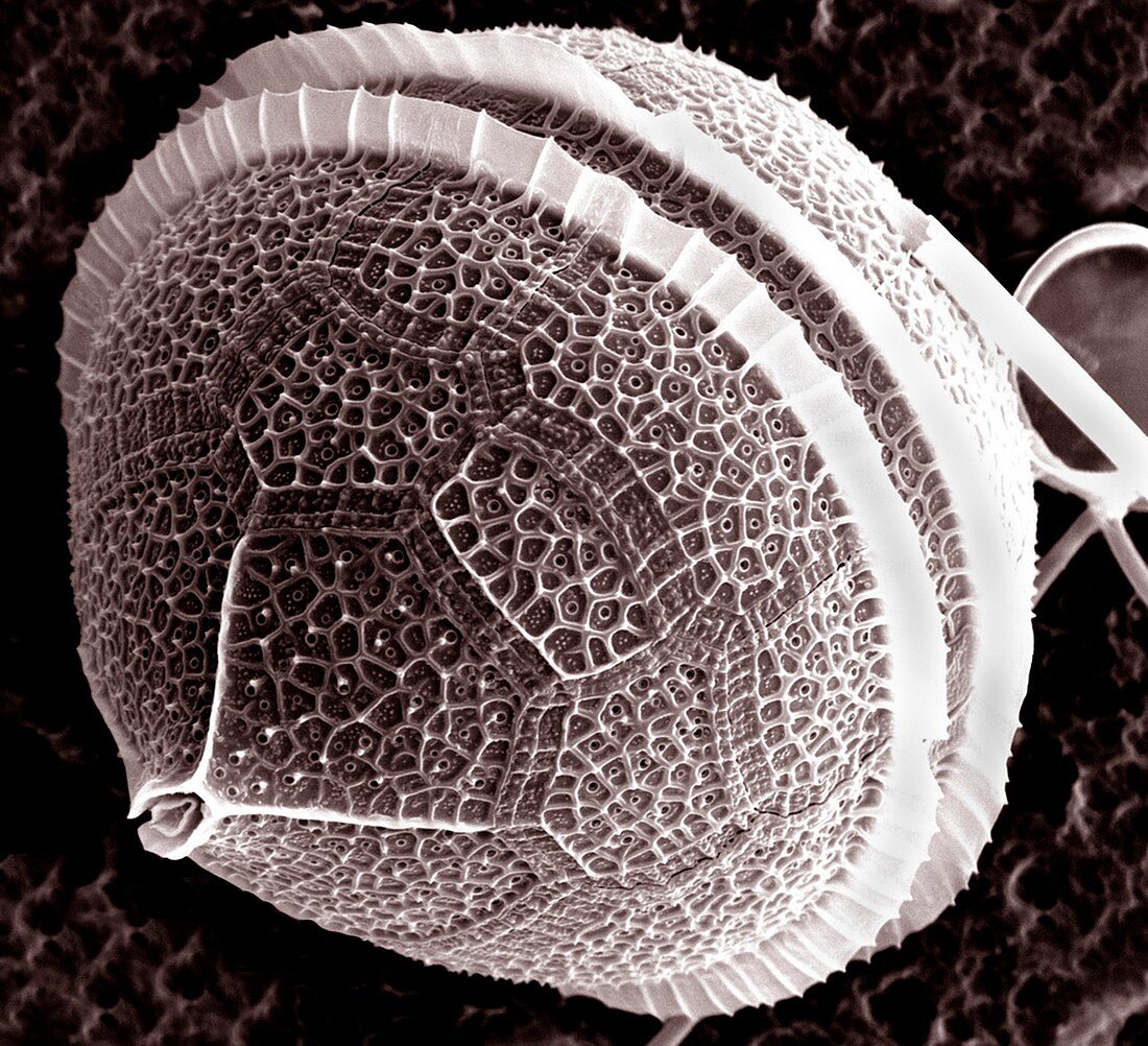 Dinoflagellate protozoan,SEM