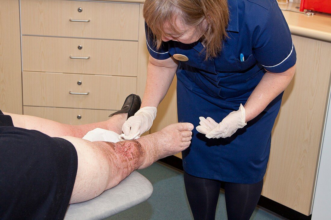 Nurse dressing a patient's leg