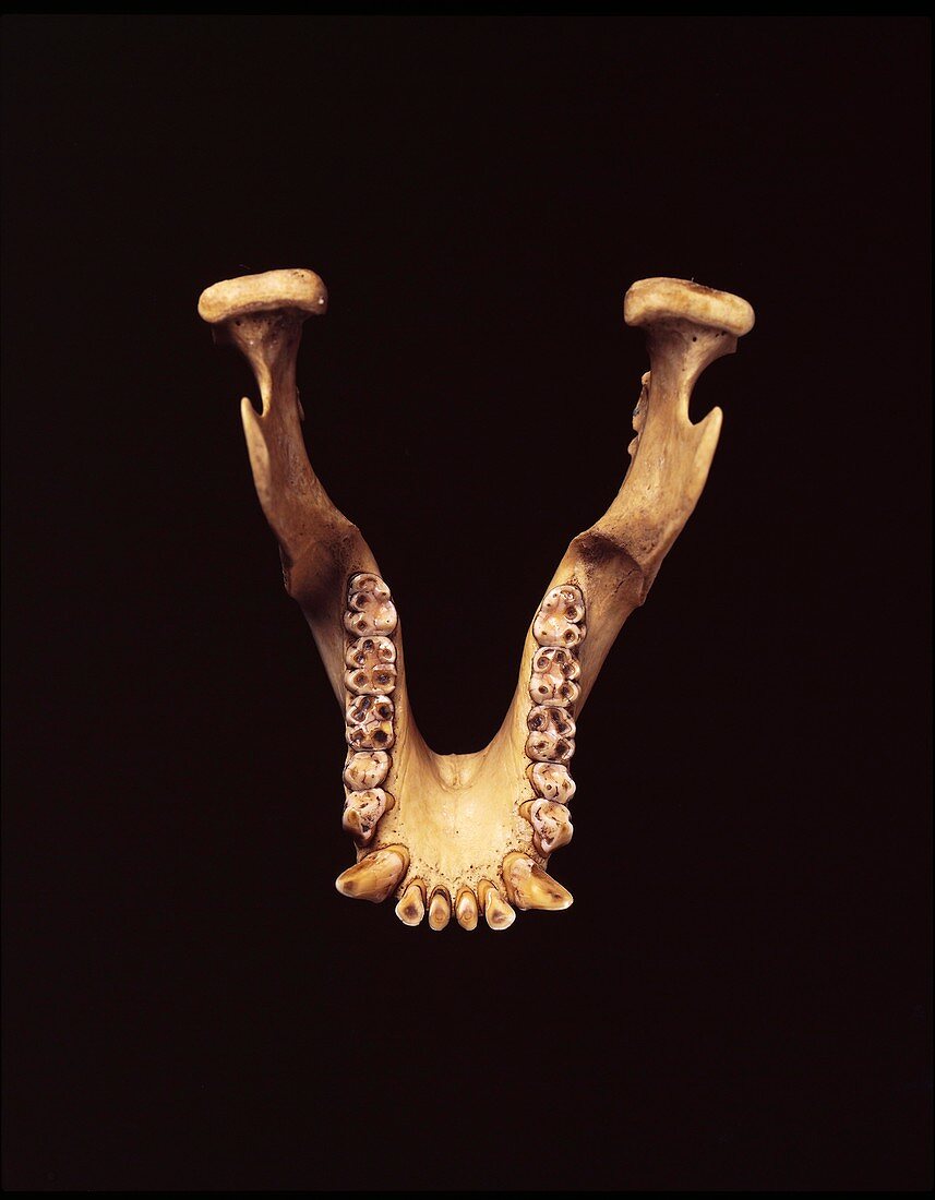 Paranthropus robustus jaw bone