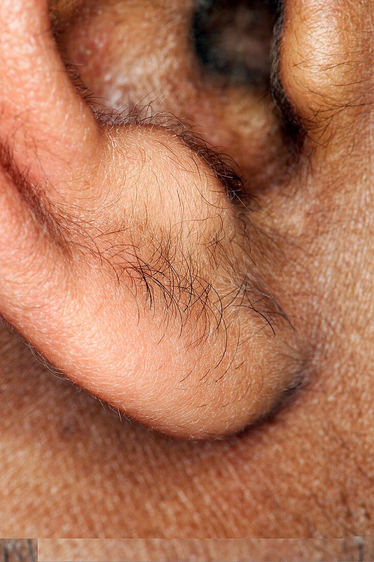 Human ear lobe