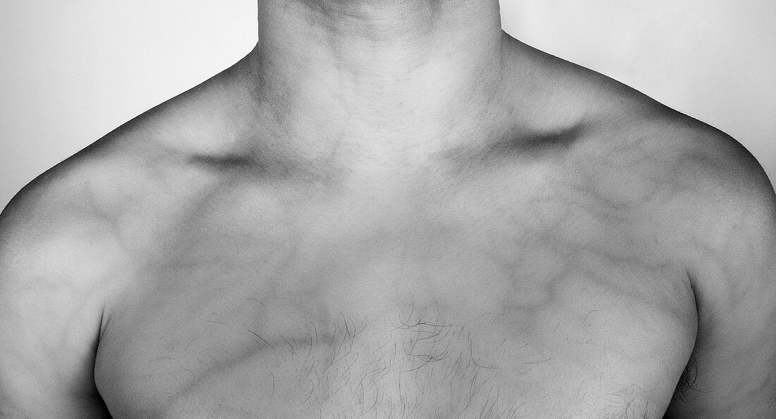 Shoulders and chest,infrared image