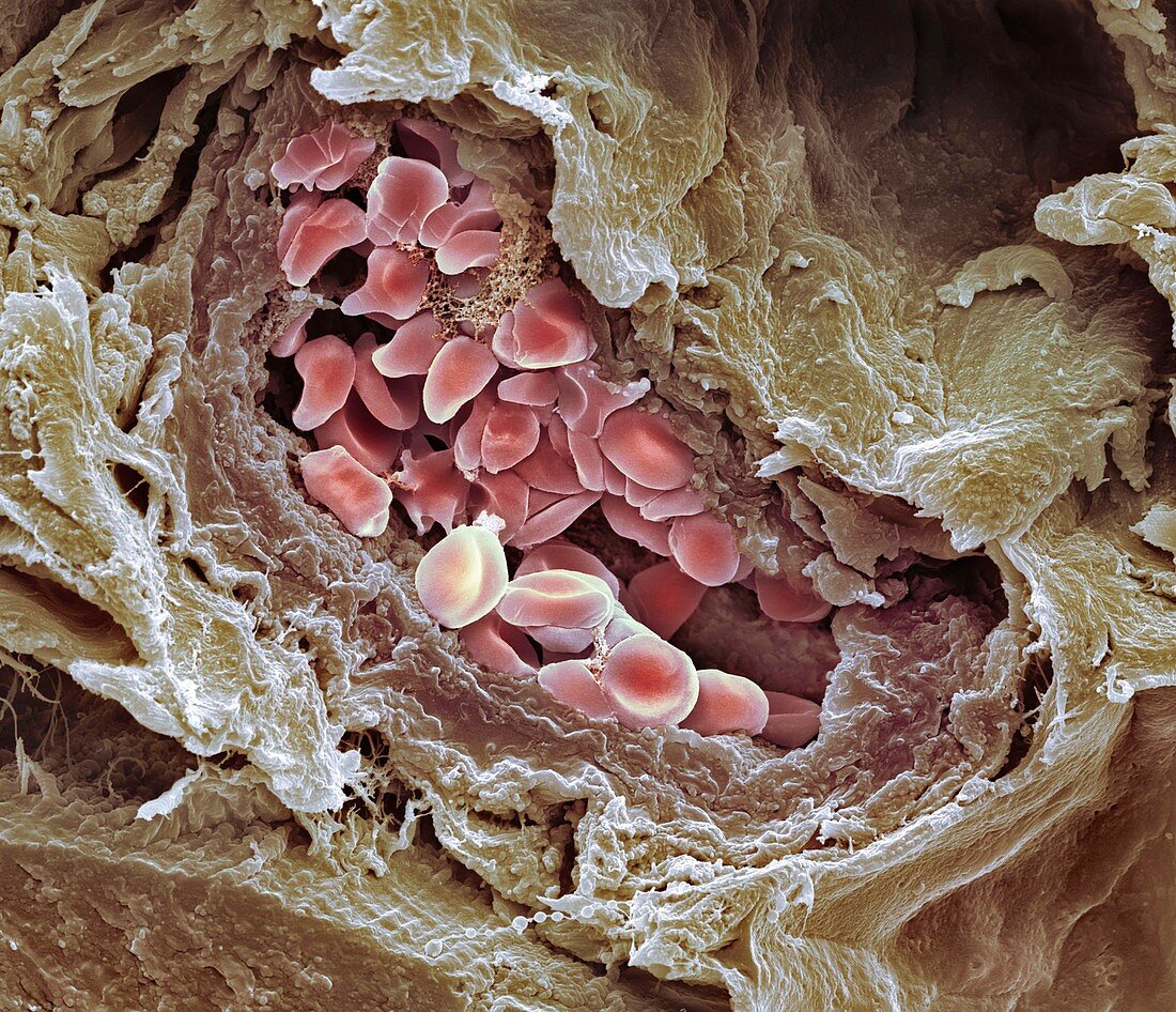 Blood-filled artery,SEM