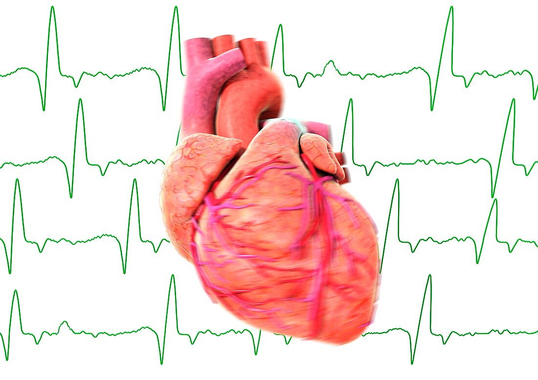 Irregular heart beat,conceptual image