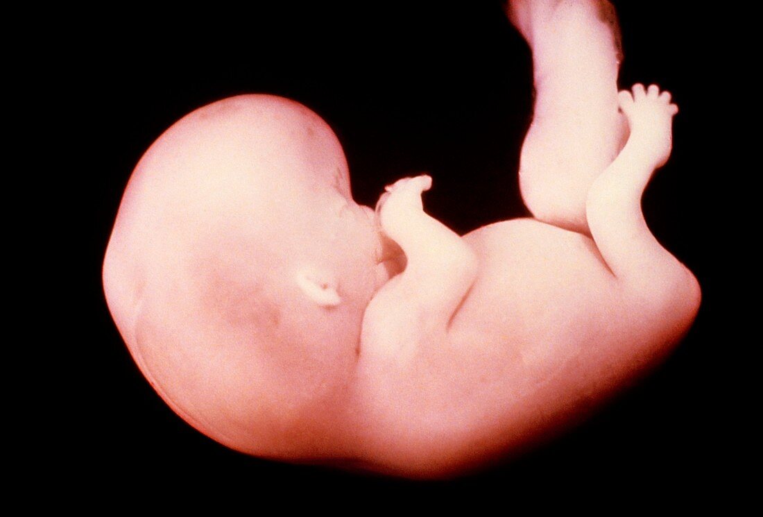 Nine week old foetus