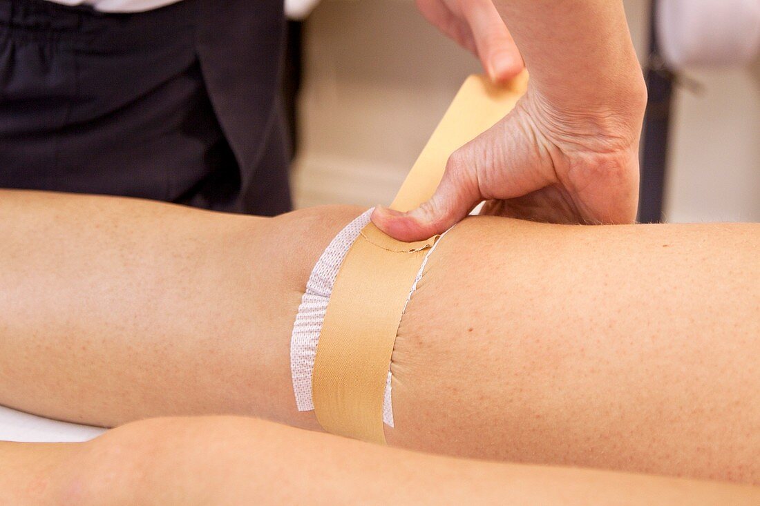 Physiotherapy knee taping