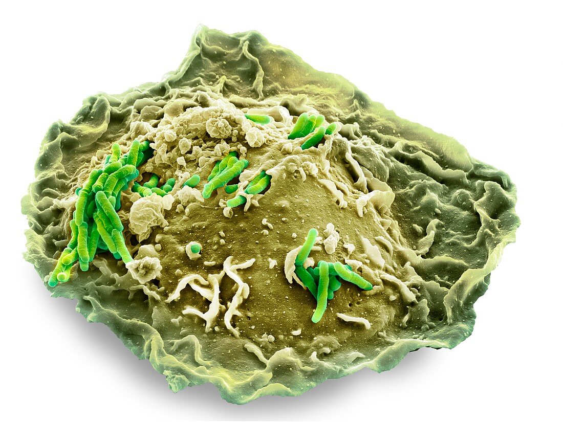 Macrophage engulfing TB bacteria,SEM