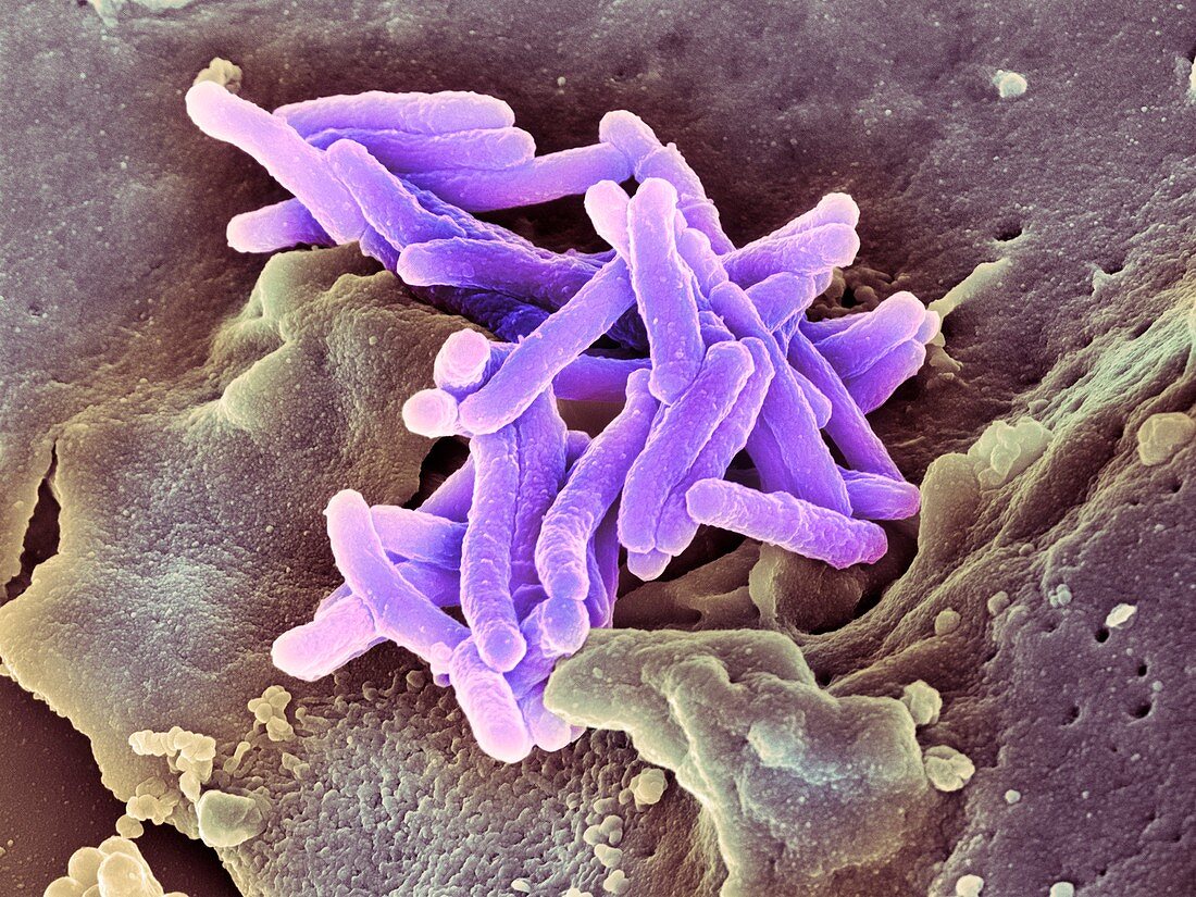 Macrophage engulfing TB bacteria,SEM