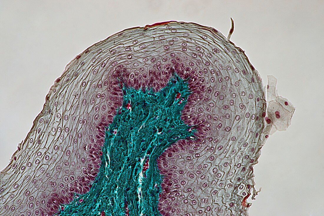 Oesophagus wall,light micrograph