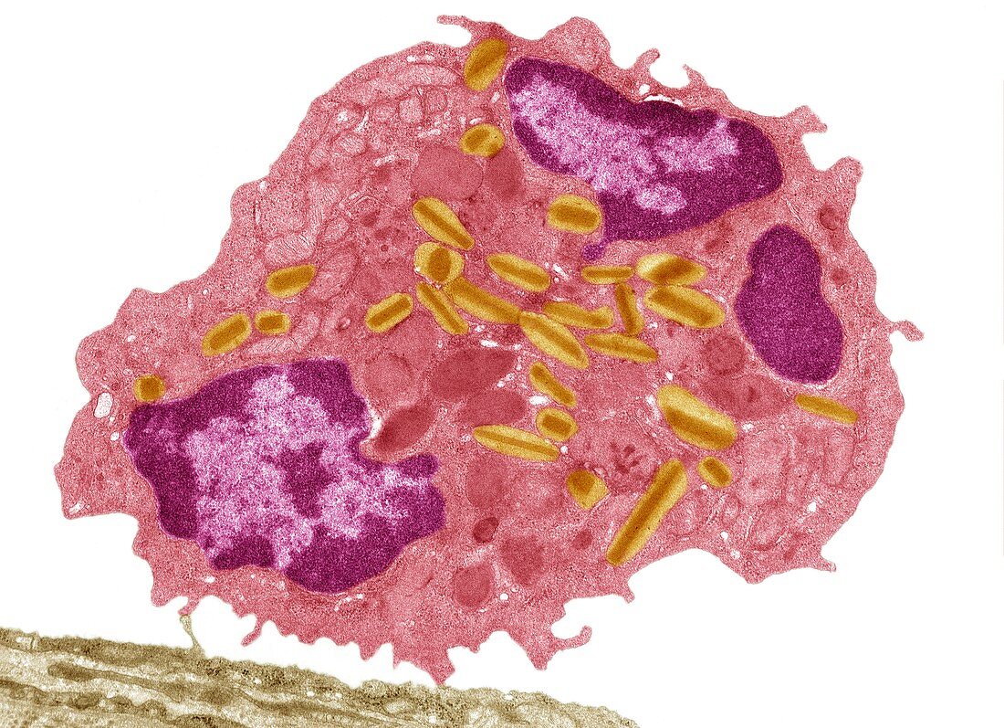 Eosinophil white blood cell,TEM