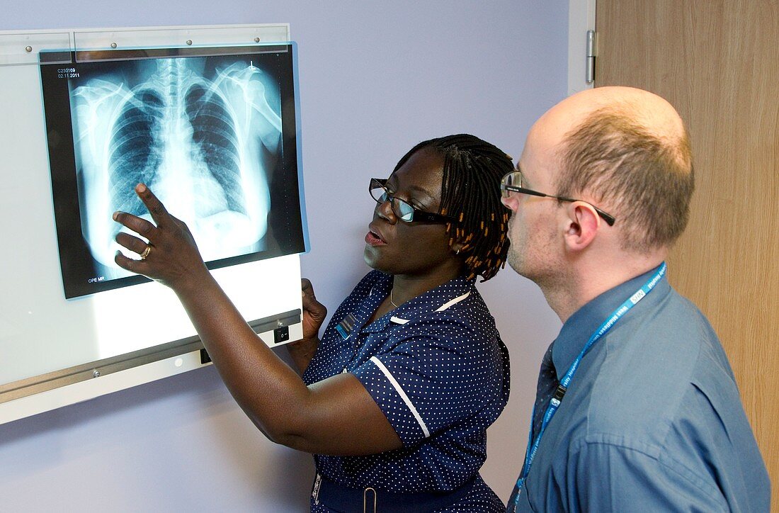 Tuberculosis X-ray diagnosis