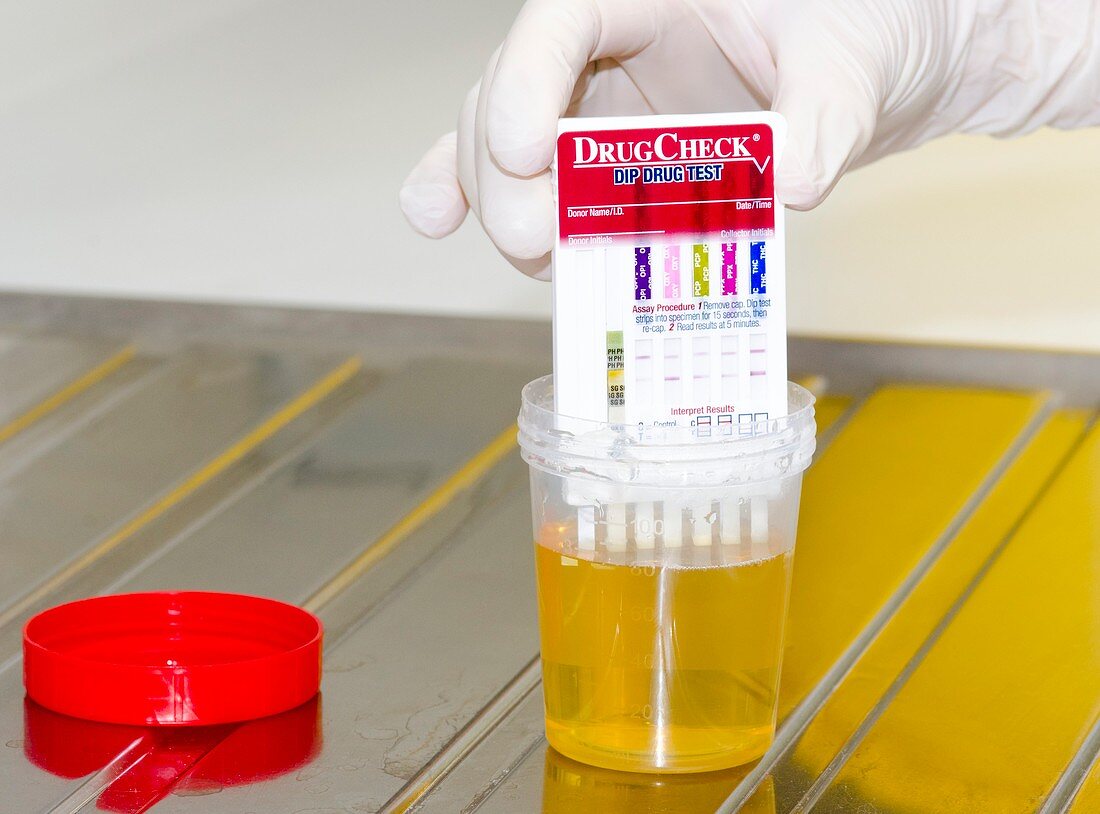 Urine drug test