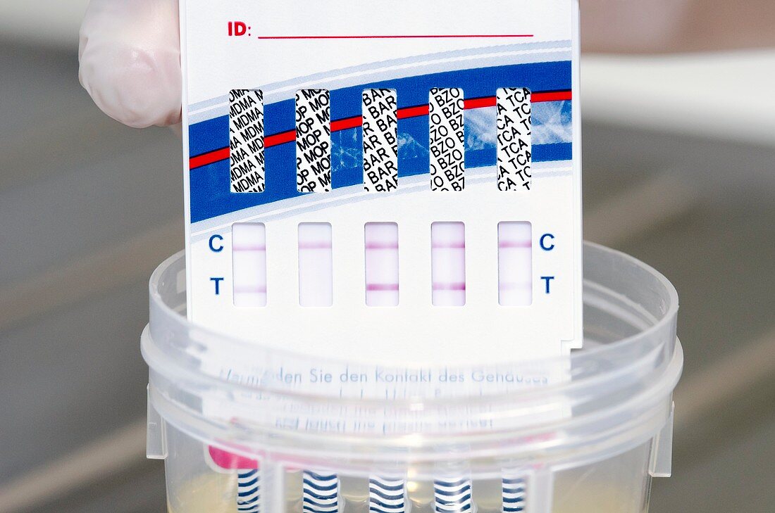 Urine drug test