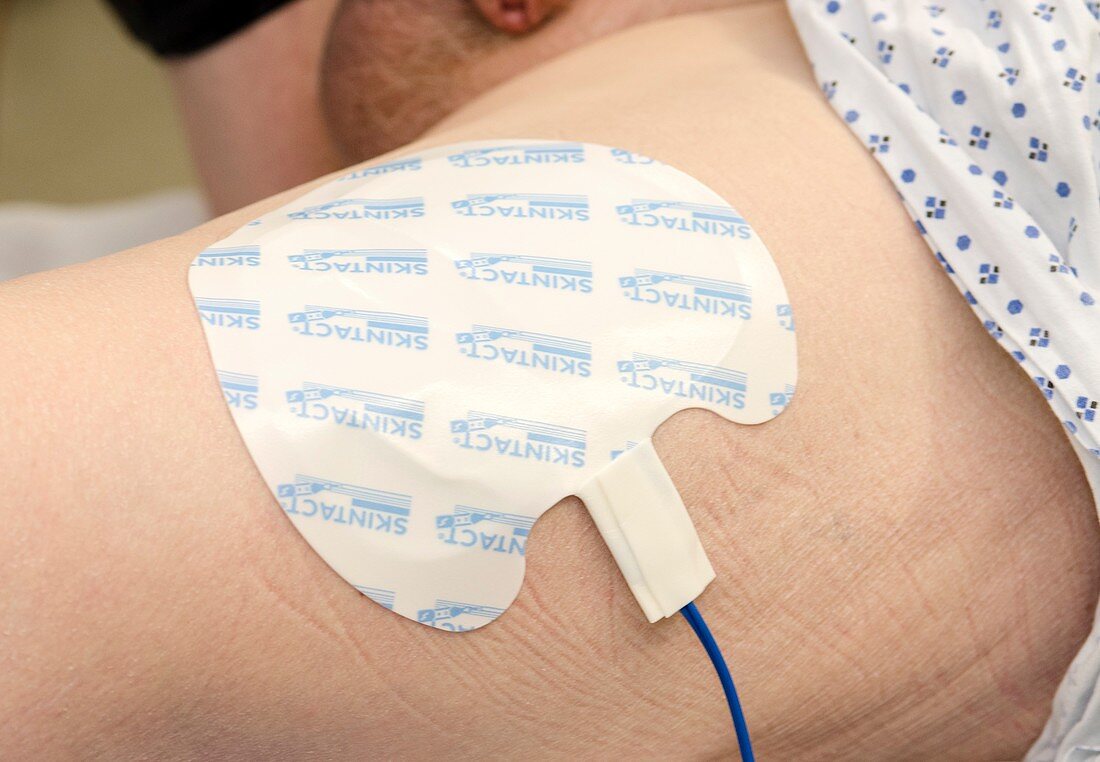 ECG electrode during surgery