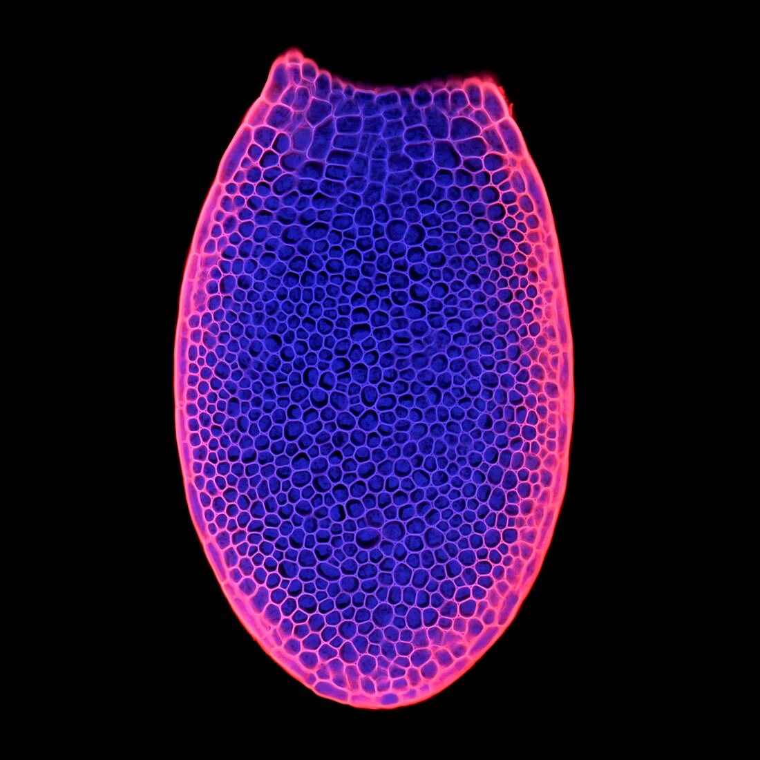 Arabidopsis thaliana embryo,micrograph