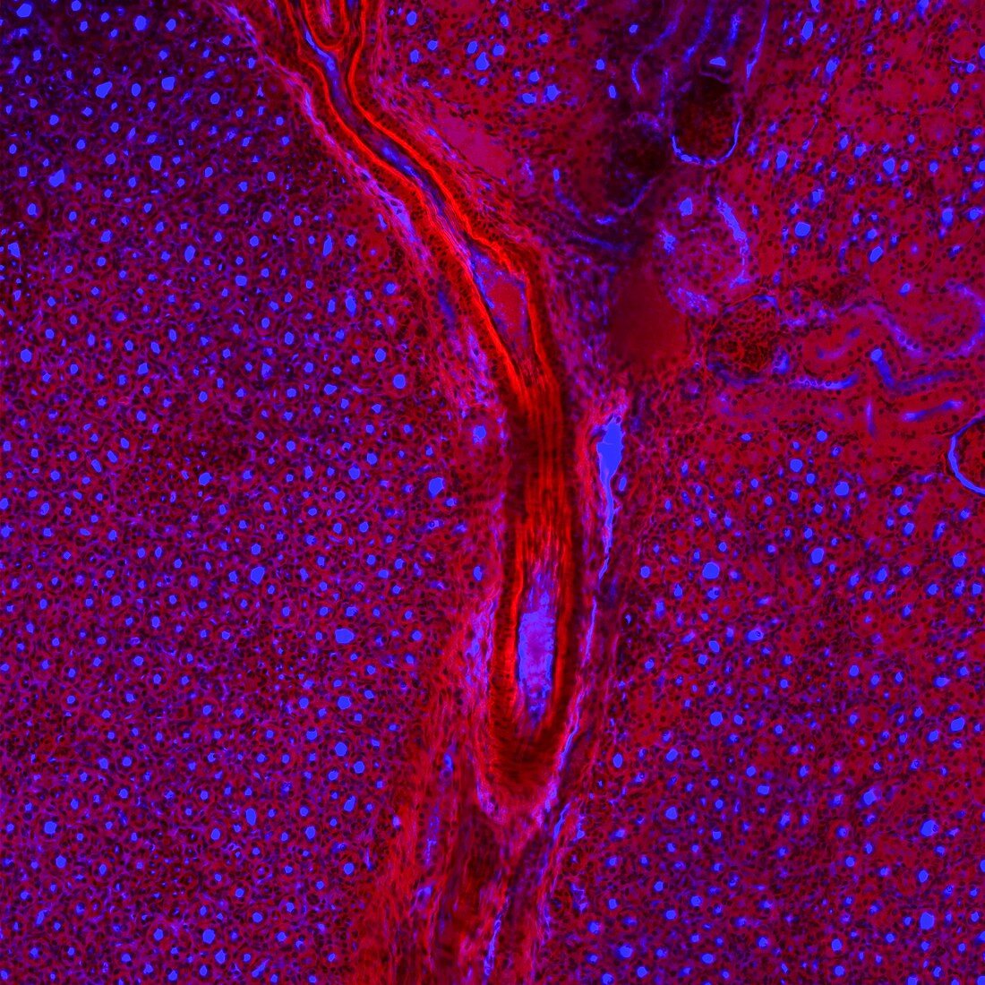 Kidney blood vessels,confocal micrograph