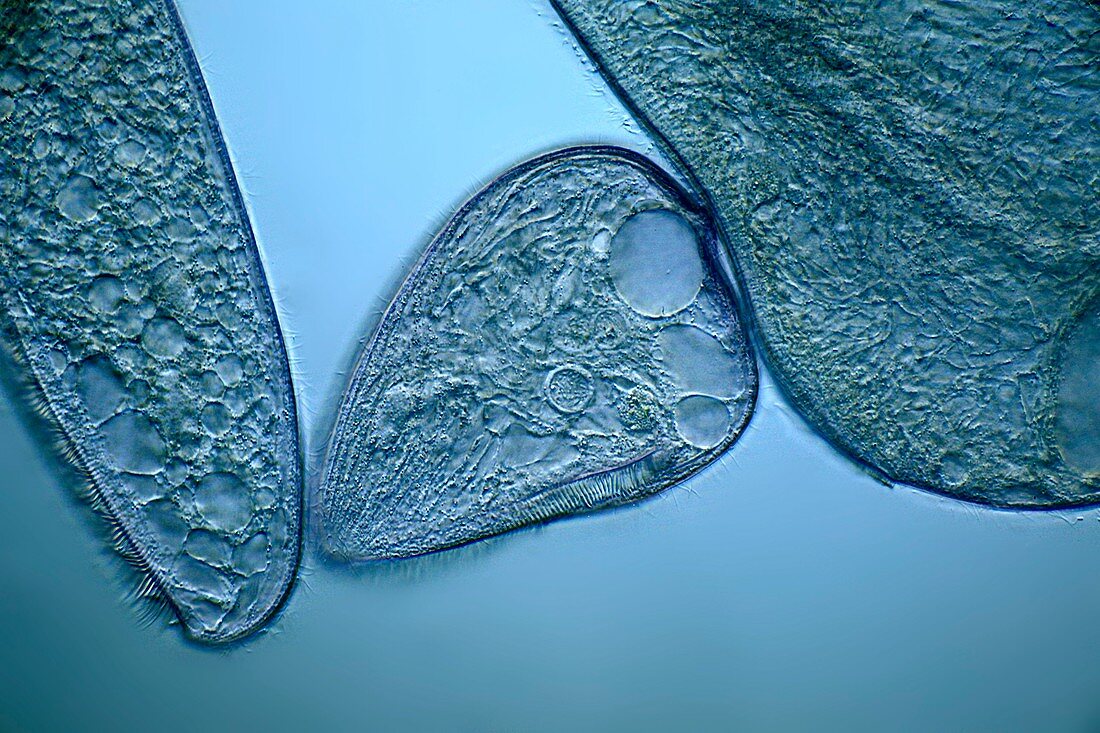 Blepharisma protozoa,light micrograph