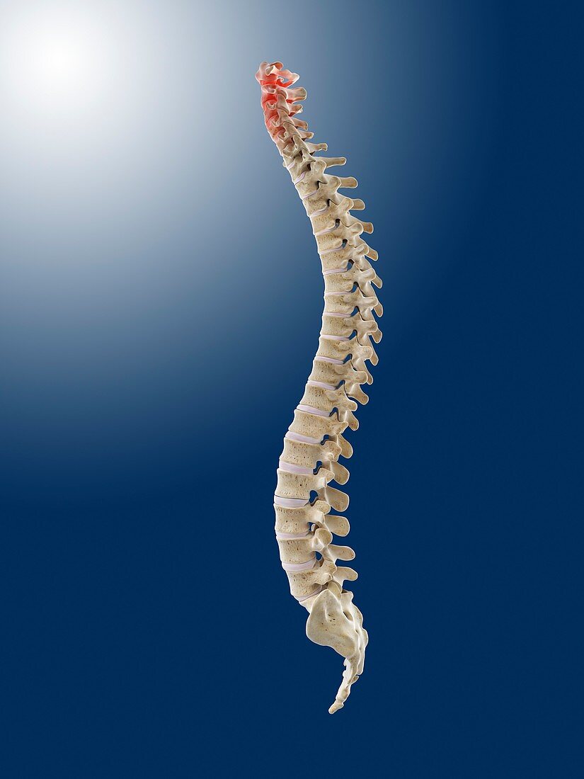 Neck pain,conceptual artwork