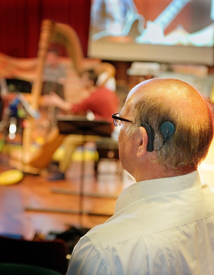 Music for Cochlear Implant wearers