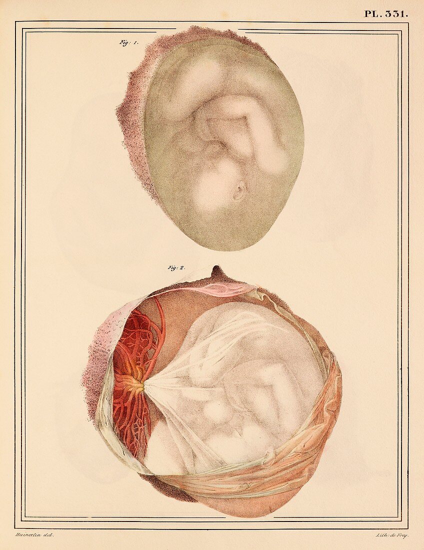 Comparing two foetuses,1825 artwork