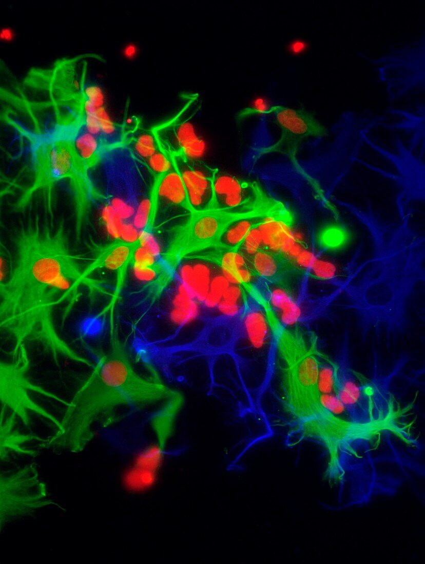 Stem cell-derived astrocyte brain cells