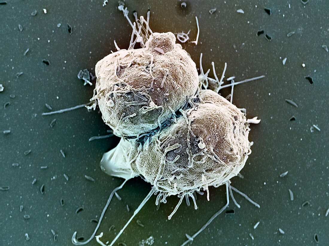 Bone marrow stem cells,SEM