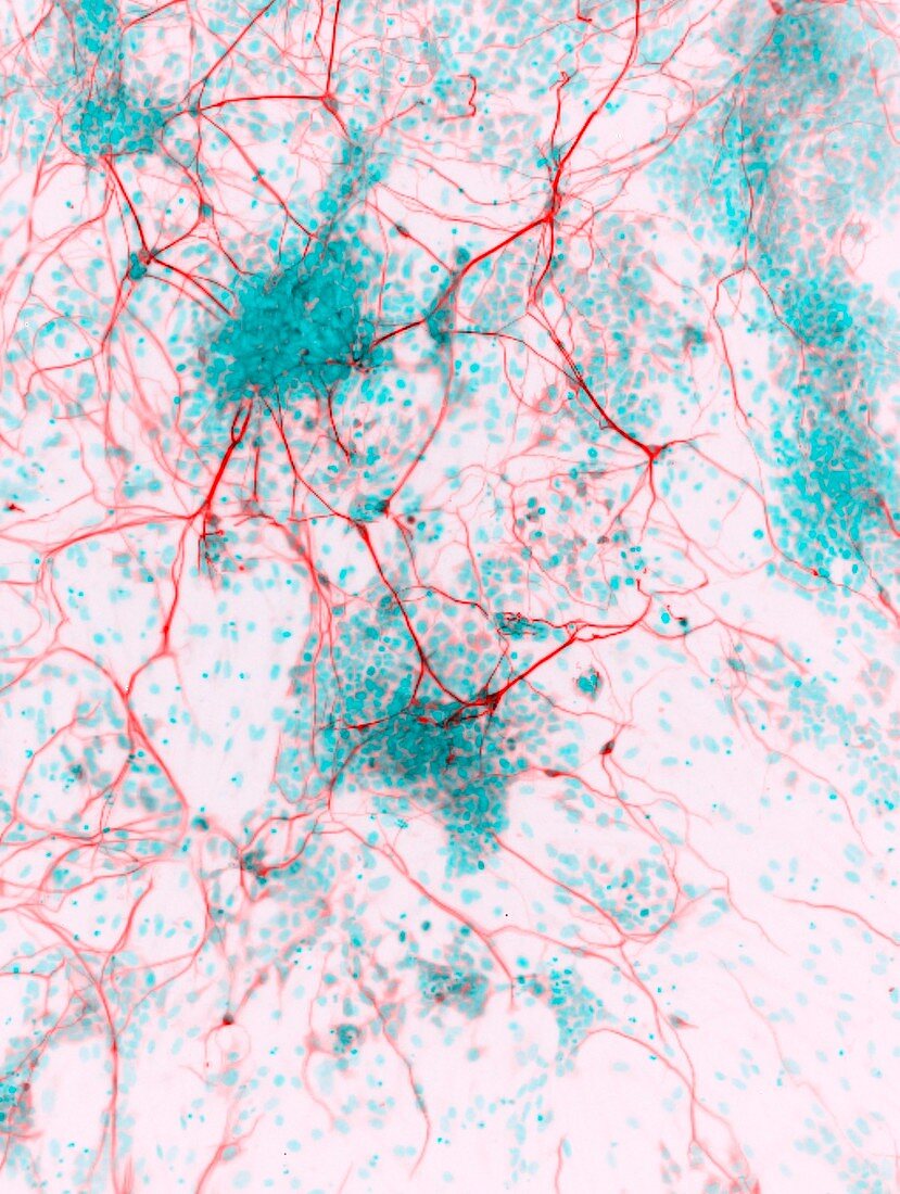 Stem cell-derived neurons,micrograph