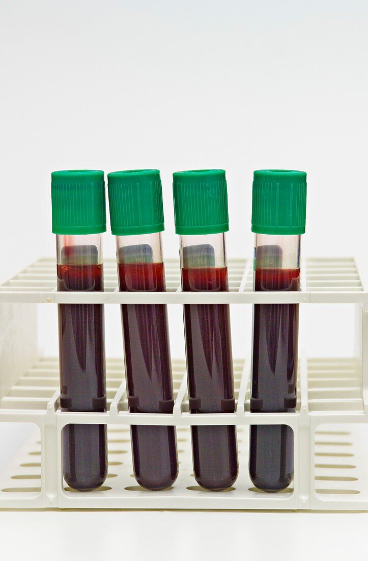 Blood specimens