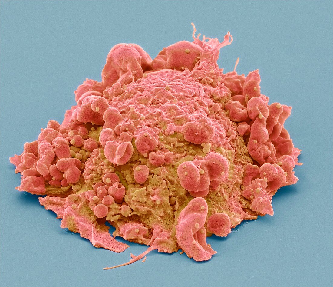 Colorectal cancer cell,SEM