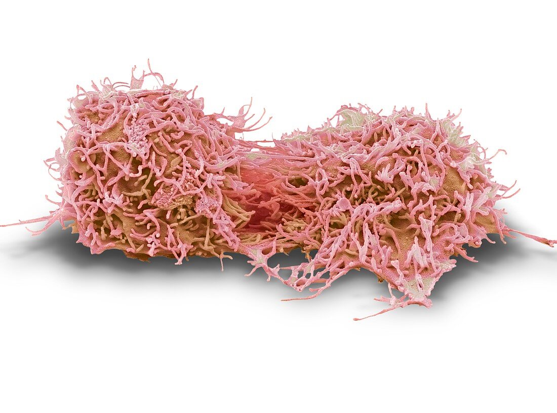 Dividing liver cancer cell,SEM