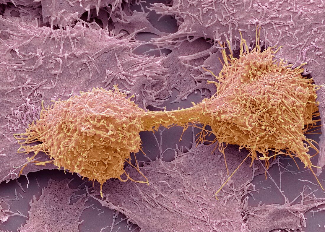Dividing liver cancer cell,SEM