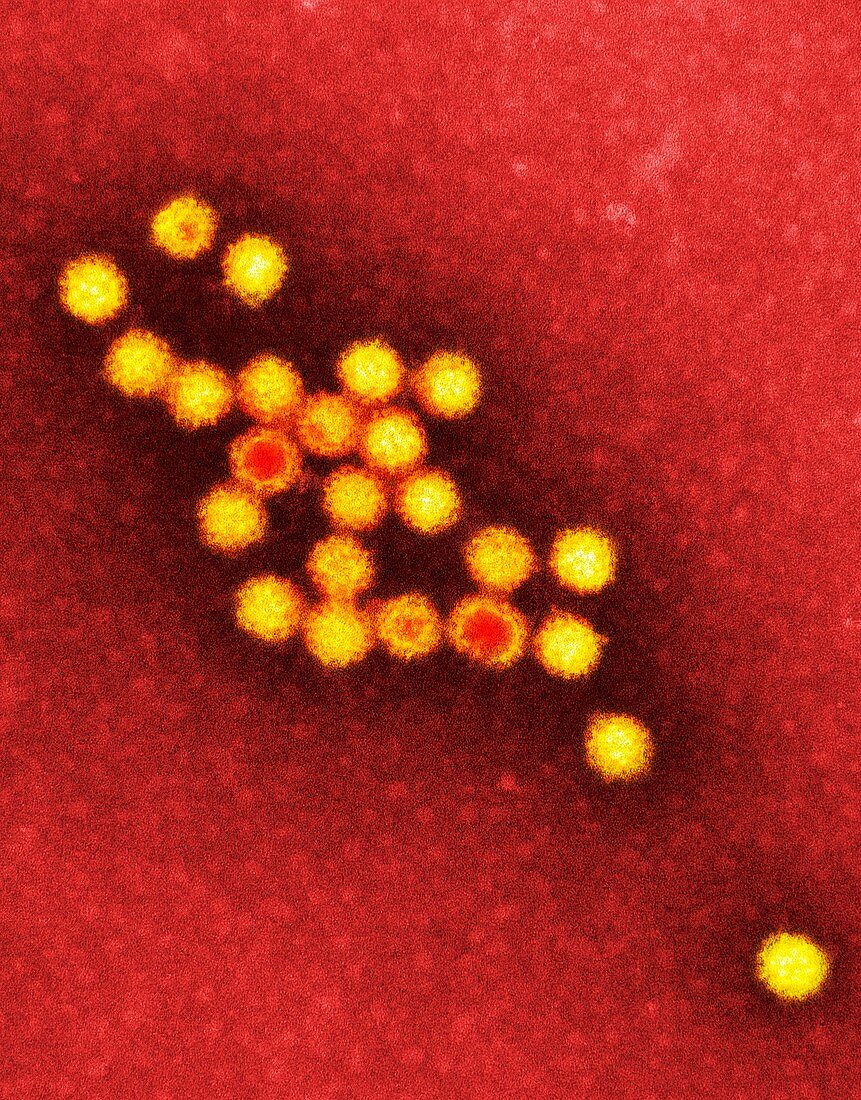 Norovirus particles,TEM