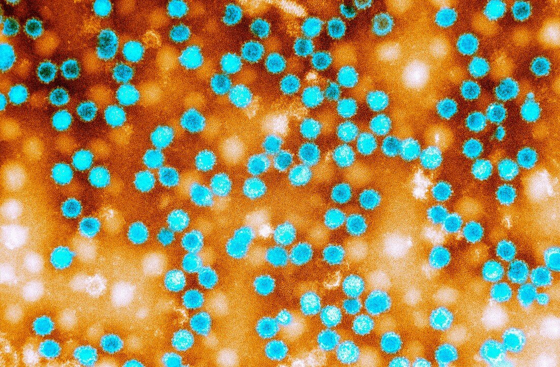 Norovirus particles,TEM