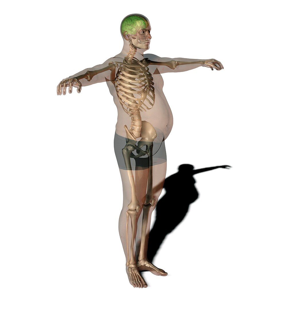 Obese man,anatomical artwork