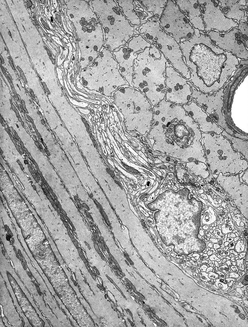 Smooth muscle of gut wall,TEM