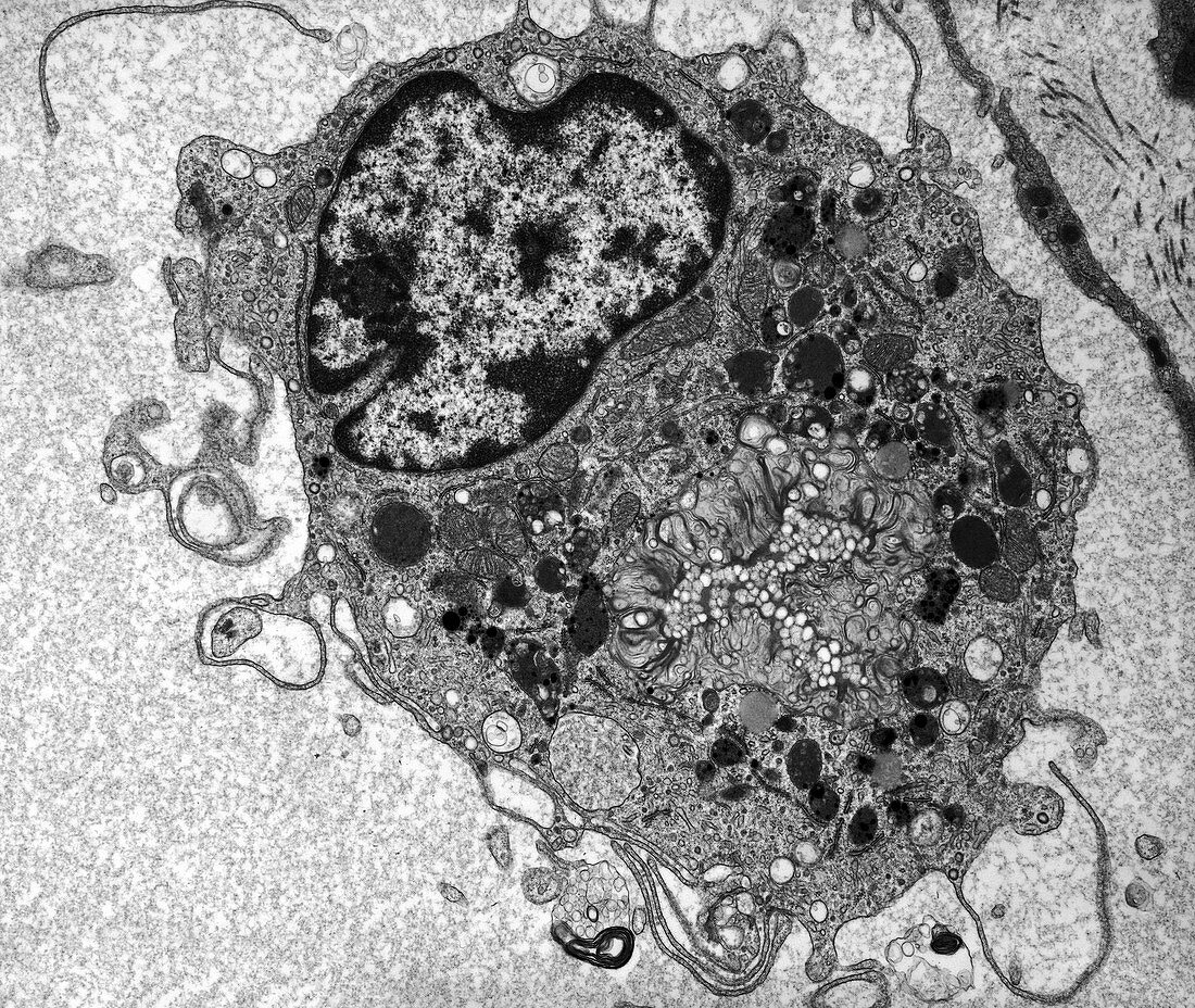 Macrophage white blood cell,TEM