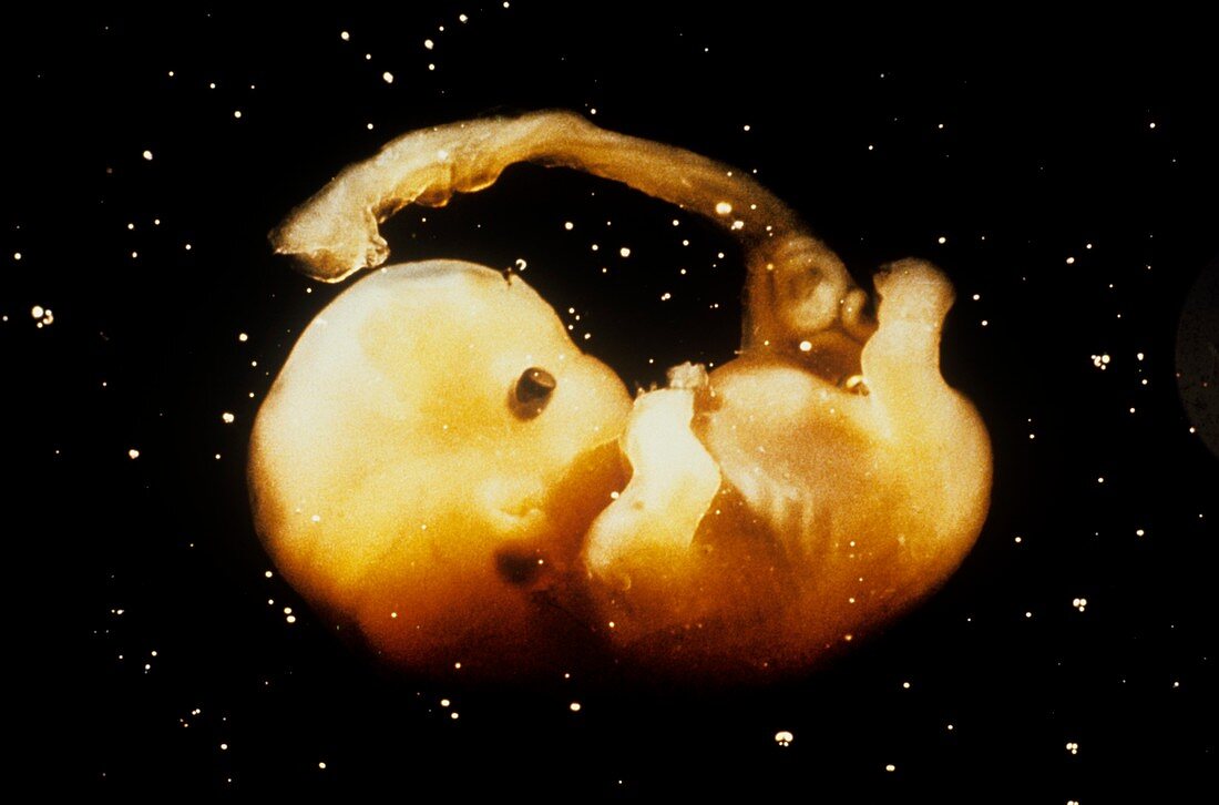 Human embryo,7 weeks old