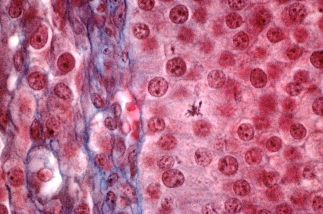 Ovarian follicle tissue,light micrograph