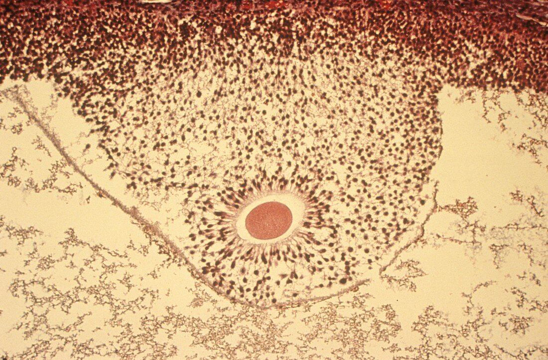 Ovarian follicle,light micrograph
