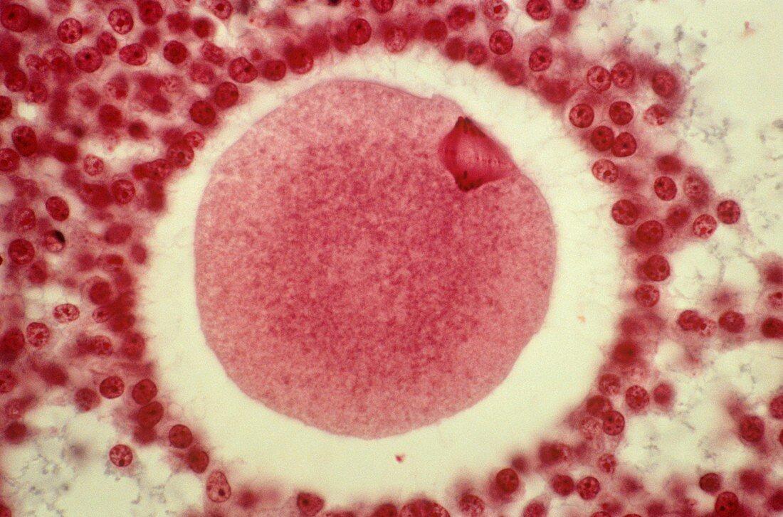 Anaphase I oocyte,light micrograph